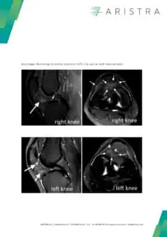 ARISTRA MRI Second Opinion Sample Report