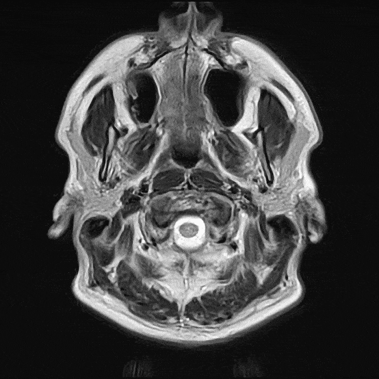MRI of the brain taken during an ARISTRA whole-body scan