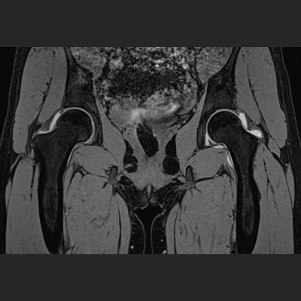MRI image of the pelvis