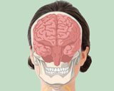 MRT Kopf/Gehirn Thumbnail